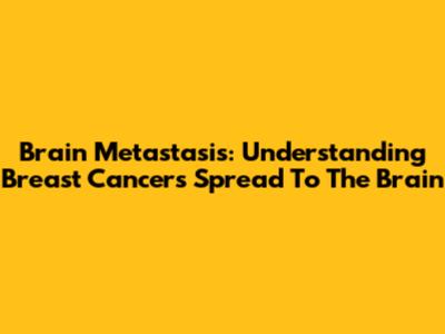 Brain Metastasis: Understanding Breast Cancer's Spread To The Brain
