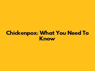 Chickenpox: What You Need To Know