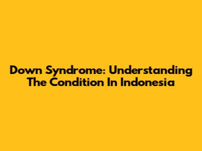 Down Syndrome: Understanding The Condition In Indonesia