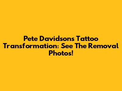 Pete Davidson's Tattoo Transformation: See The Removal Photos!