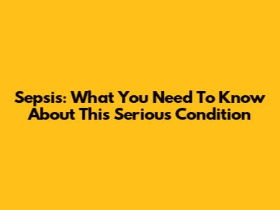 Sepsis: What You Need To Know About This Serious Condition