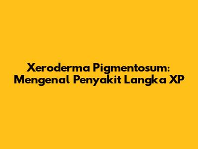 Xeroderma Pigmentosum: Mengenal Penyakit Langka XP